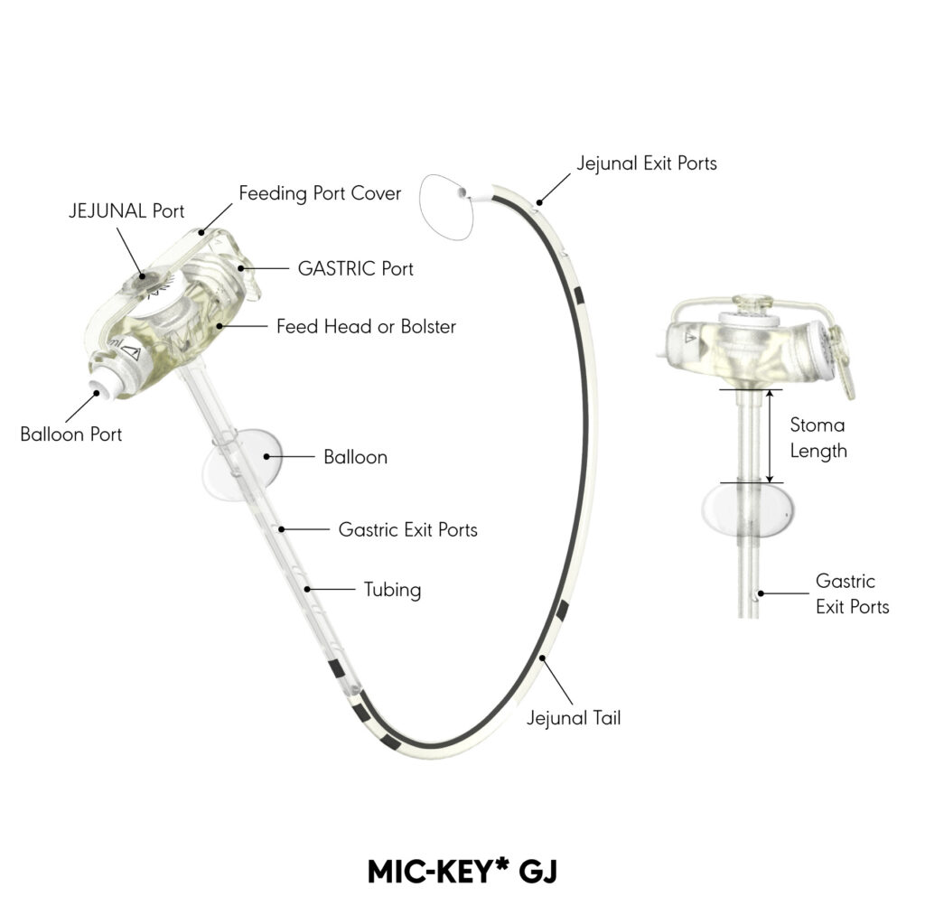 MIC-KEY* GJ product diagram