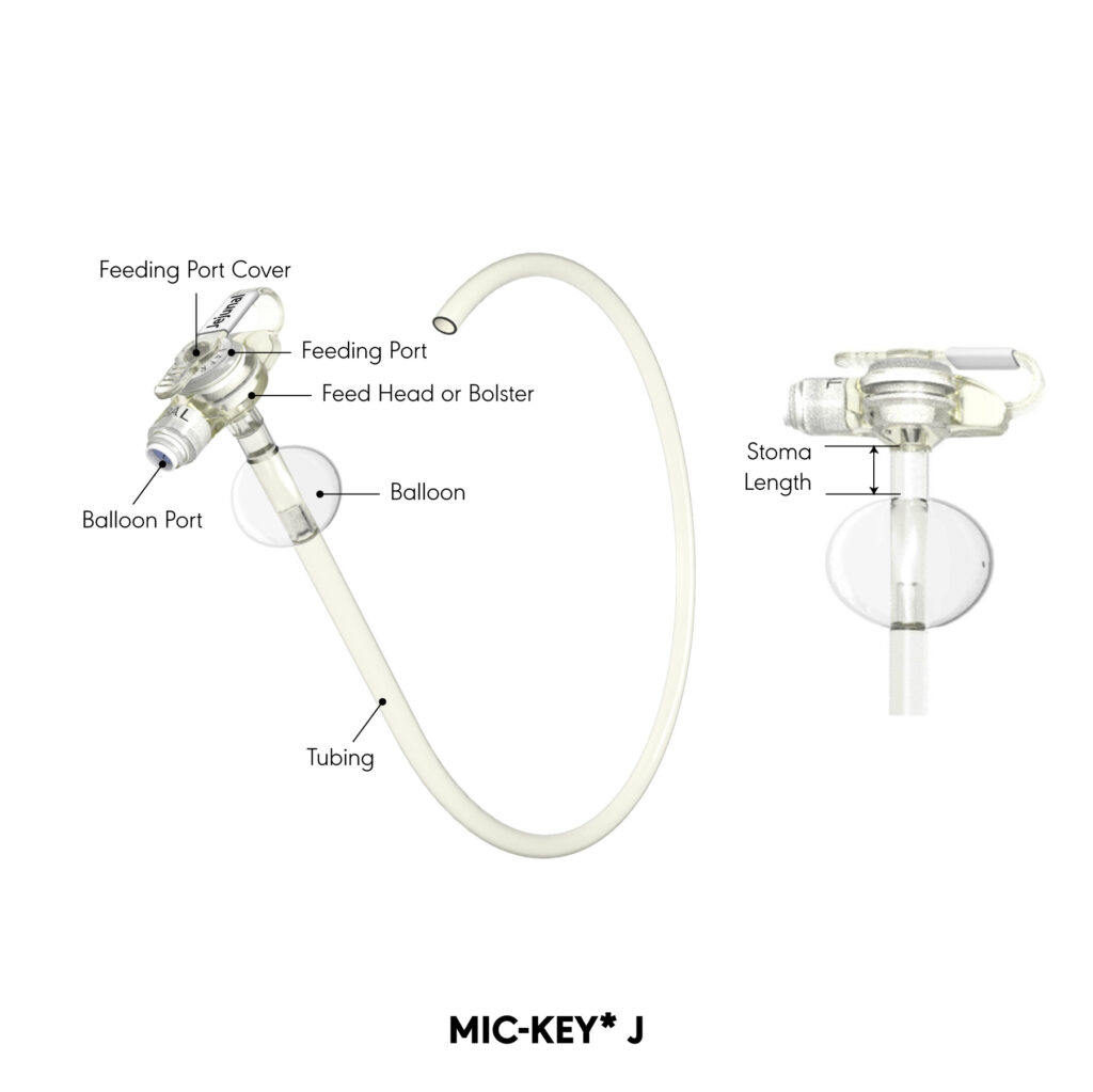 MIC-KEY* J product diagram